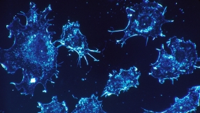 Cancer cure news 2015: Potentially new way to stop cancer from spreading discovered