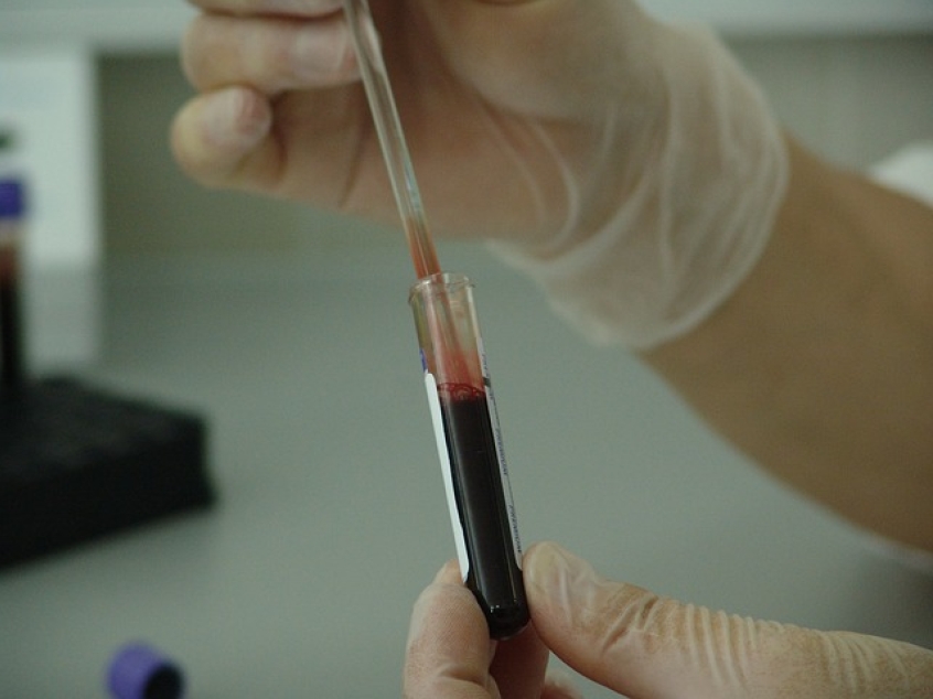 Cancer detection, identification: Blood tests for fetal abnormalities ...