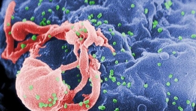 HIV/AIDS Cure news: New treatment may be making advances in reducing transmission