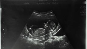 Remembering over 10 million lives lost to abortion in the UK